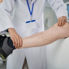 разширени вени при мъжете